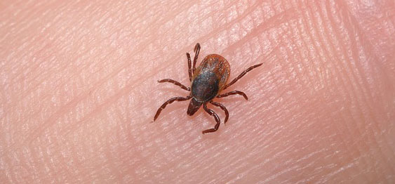 כינים וטיפול בכינים